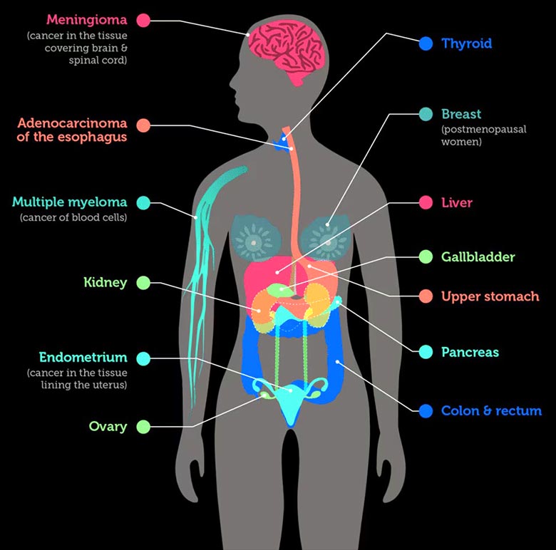 dexa scan body diagram