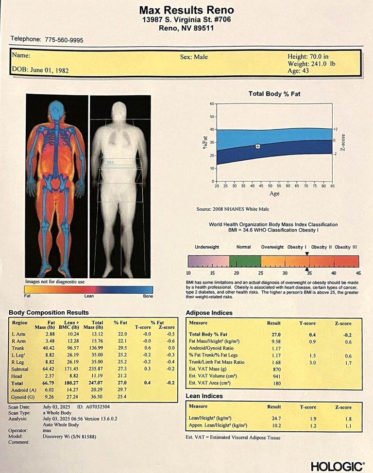 Dexa Scan Read-out